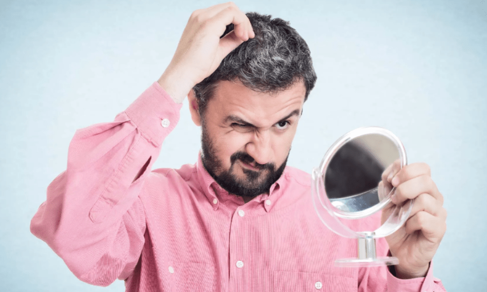 smoking can contribute to hair loss