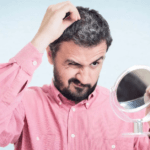 smoking can contribute to hair loss