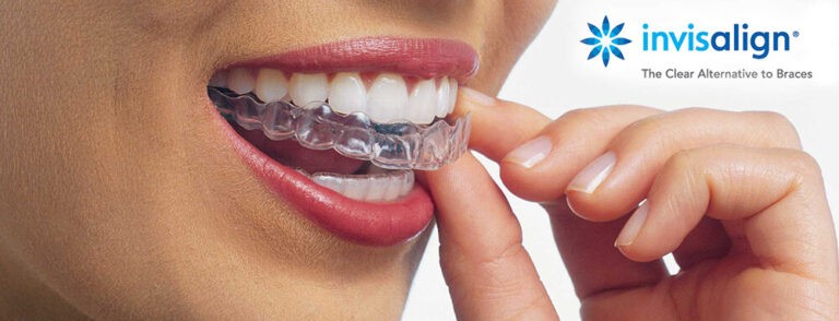 invisalign doctor site login