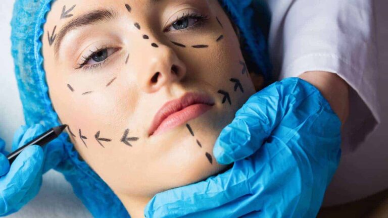 Preparing for Plastic Surgery